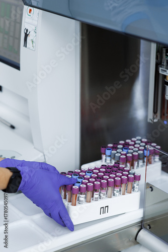 laboratory for research of tests, the doctor loads into the research device