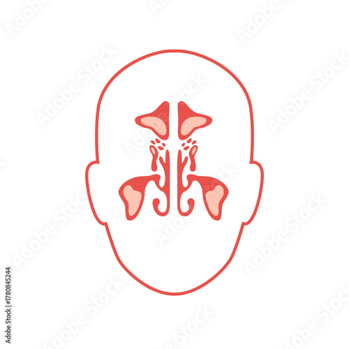 The vector infographic scheme of face anatomy with sinusitis. Sinus and frontal inflammation with mucus as a result of infection