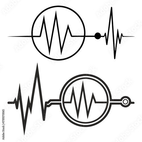 Two electrocardiogram waveforms showing heart activity