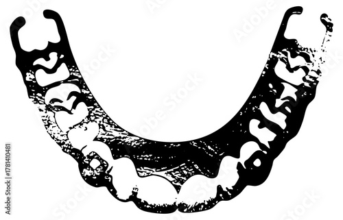 Jawbone Illustrates Anatomy in Medical Education