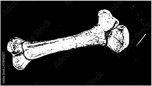 Human bone illustrates anatomy in medical education