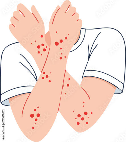 Minimal flat illustration showing a person with crossed arms covered by red rash spots, useful for healthcare, dermatology, allergy, or infection awareness content