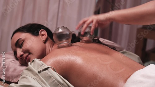 Beauty Latino woman is treated for healthy recovery with cupping therapy by Asian physical muscle doctor, an oriental traditional medicine therapist at a spa clinic, and wellness massaging lifestyle.