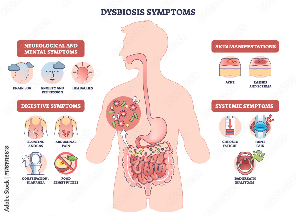 Naklejka premium Dysbiosis symptoms visual shows gut imbalance across body, human silhouette with intestines and bacteria icons highlights digestive, skin, mental signs, transparent background.