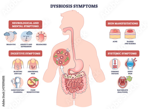 Dysbiosis symptoms visual shows gut imbalance across body, human silhouette with intestines and bacteria icons highlights digestive, skin, mental signs, transparent background.