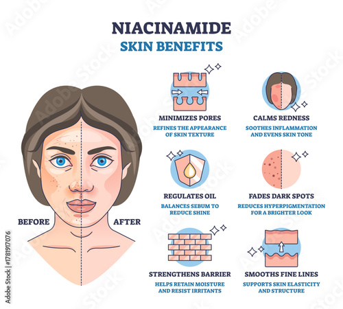 Niacinamide skin benefits diagram shows a before-after face, pore arrows and skin barrier icons, conveying calm tone, fewer spots, and smoother texture, transparent background.