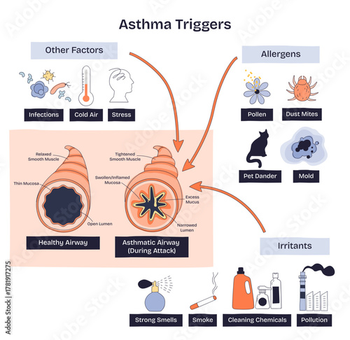 Asthma triggers overview shows airway narrowing with key culprits, pollen, smoke, dust mites, aiding prevention, transparent background. Doodle style diagram
