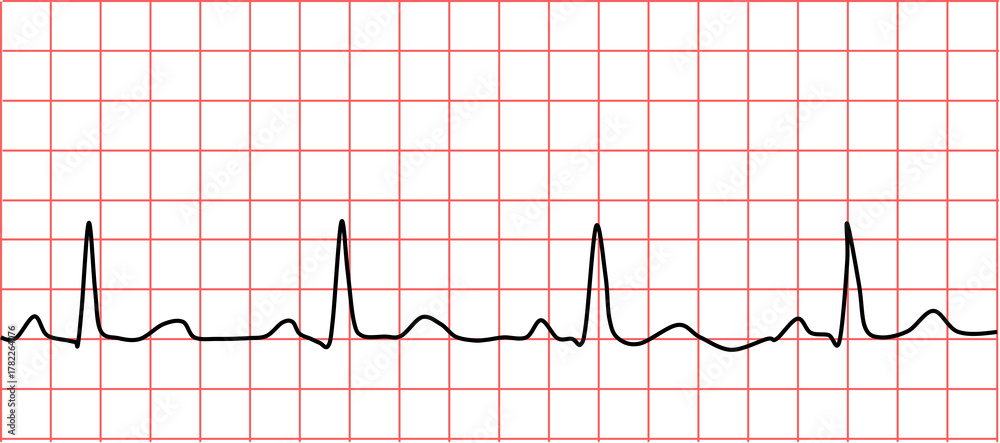 Naklejka premium 心電図のグラフィック素材イラスト