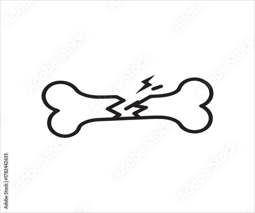 Broken Bone Illustration Depicting Fracture Injury and Medical Condition Healthcare