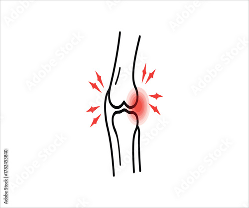 Knee Pain Inflammation Illustration Showing Joint and Bone Discomfort Anatomy