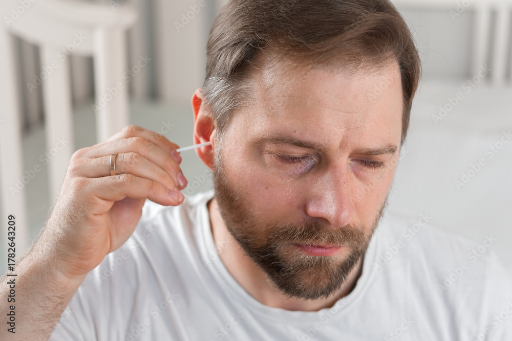 Obraz premium Handsome man cleaning ear with cotton swab wear white t-shirt sitting at home light bedroom. Guy doing ears hygiene procedure, grooming body. Self care. Softly lit indoor space. Male morning routine.