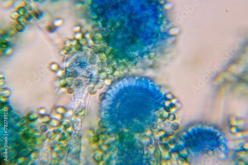 Photos Microscopic View of a Fungal Head (Conidiophore) with Blue S