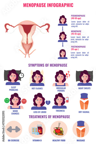 Menopause Infographic with Symptoms Stages and Health Tips for Women Education