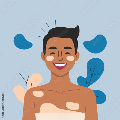 Flat minimal vector for World Psoriasis Day featuring healing hands, skin layers, awareness ribbon, supportive community & skincare infographic design