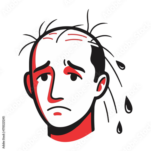 Stress and Hair Loss - Emotional Impact of Baldness