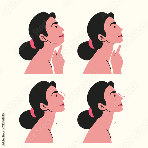 Plastic Surgery woman considering cosmetic surgery to enhance her facial features