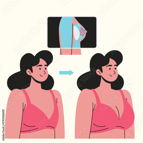 Plastic Surgery woman undergoing breast augmentation surgery to enhance her body shape and boost her confidence-02