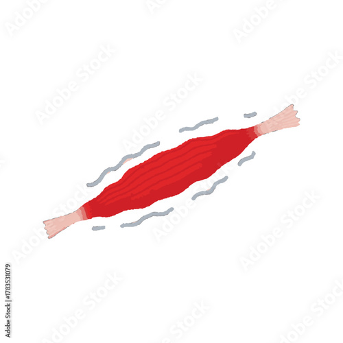 Muscle spasm or cramp illustration.