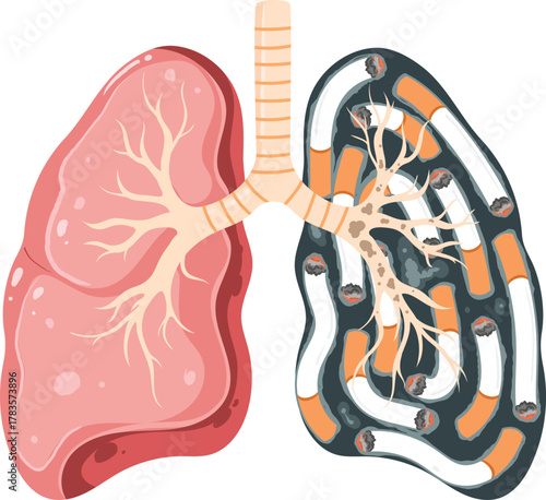PrintSmoking's Devastating Impact on Lungs A Visual Comparison