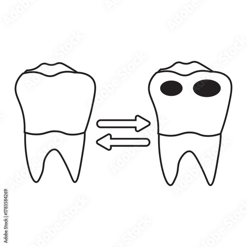 tooth replacement