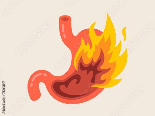 This illustration creatively depicts a burning stomach, symbolizing the discomfort of heartburn, with flames emanating from within the stomach area showcasing irritation.
