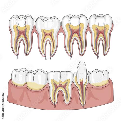 Illustration of Tooth Decay and Gum Disease Progression.