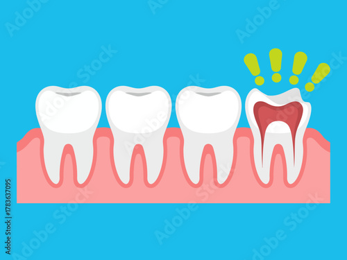 This cartoon-like illustration depicts a tooth experiencing pain with expressive cues and alarms, emphasizing the significance of dental health and care in everyday life.