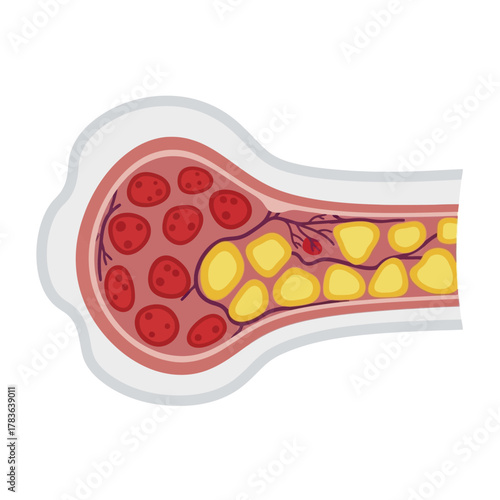 Bone marrow cross section showing red blood cells and fat cells.