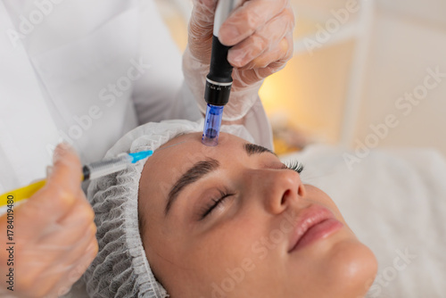 Fotografía Peeling, woman health care, skin regeneration, dermapen microneedling, dermastamp