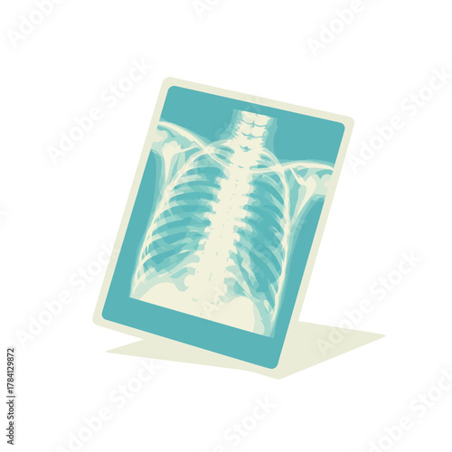 Radiograph Xray Film Icon Representing Medical Imaging