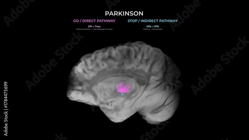 Parkinson Dopamine Loss Basal Ganglia Motor Circuit Transparent Sagittal View