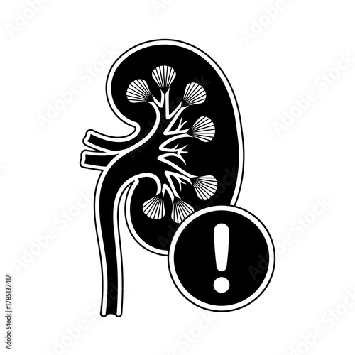 Illustration of a kidney with internal structures and an exclamation point in a circle below it icon