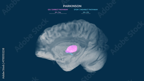 Parkinson Dopamine Loss Basal Ganglia Pathway Imbalance Sagittal View