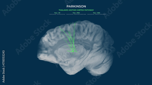Parkinson Dopamine Loss Thalamo–Motor Cortex Pathway Hypoactivity Sagittal View