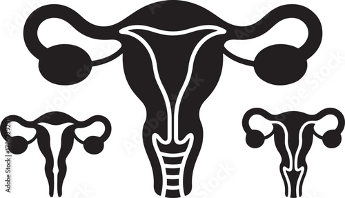 Black silhouette vector of female reproductive system anatomy with three uterus diagrams ovaries fallopian tubes
