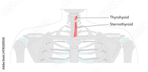 Sternohyoid Thyrohyoid - Human infrahyoid muscle shown in labeled anatomy diagram responsible for depressing the hyoid bone, aids in swallowing and speech, medical reference and cervical region.