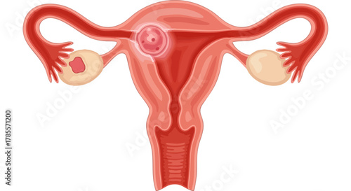 Understanding Cervical Cancer Causes, Symptoms, and Prevention Strategies for Women's Health