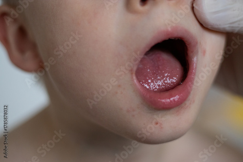 Close up of a pediatrician doctor checking a boys tongue and mouth