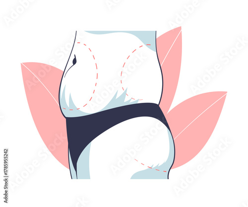 Plastic Surgery with Belly Body Part Correction in Aesthetic Beauty Clinic Vector Illustration