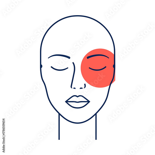Headache Pain Symptom Focused Highlight on Temporal Area Illustration