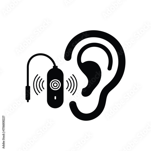 Illustration of a cochlear implant device near an ear