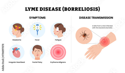 Lyme disease symptoms. Fever, headache, fatigue, irregular heartbeat, facial palsy, erythema migrans. Disease transmission from tick bite infected bacteria borrelia. Educational medical poster.