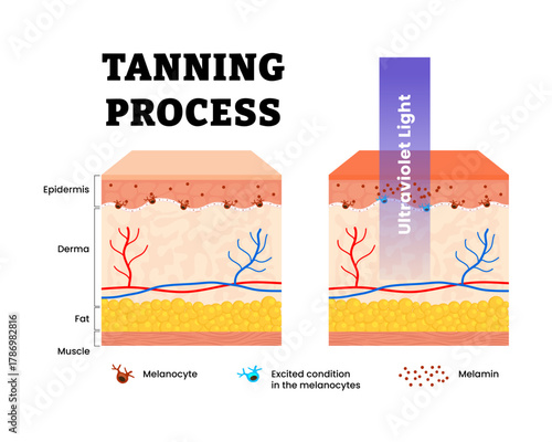 Tanning process skin with ultraviolet light waves touch melanocyte, increase the melamins production. Skin become dark color. Human skin layers anatomy cross section. Vector illustration.
