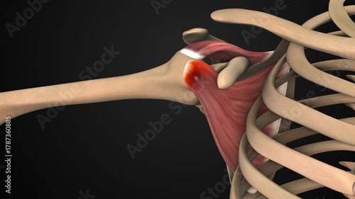 Feeling Sharp Shoulder Pain Radiating to Arm Bone
