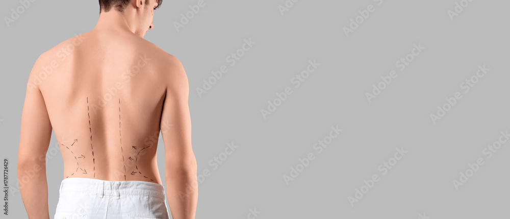 Obraz premium Young man with markings on his back against grey background. Plastic surgery concept