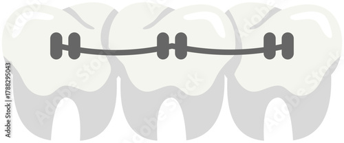 Dental Braces Illustration. Editable Color Vector