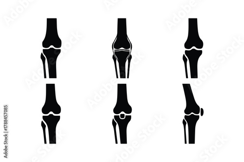 Knee joint bone silhouette vector set