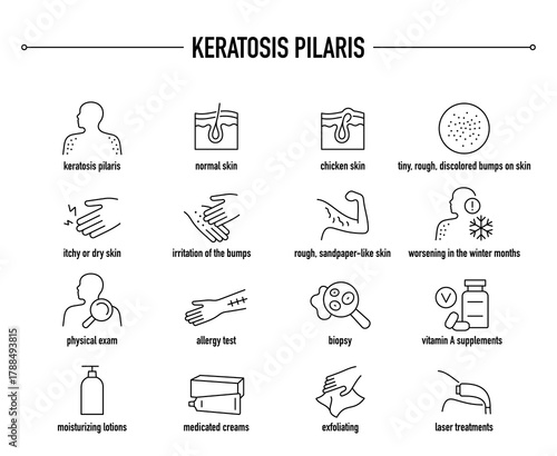 Keratosis Pilaris symptoms, diagnostic and treatment vector icon set. Line editable medical icons.