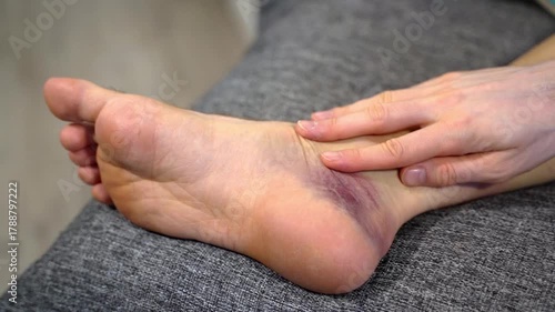 Gentle male hand glides over bruised inner ankle on resting foot, showing signs of post-traumatic swelling. Concept of home care for recovery and ease pain through intentional body awareness