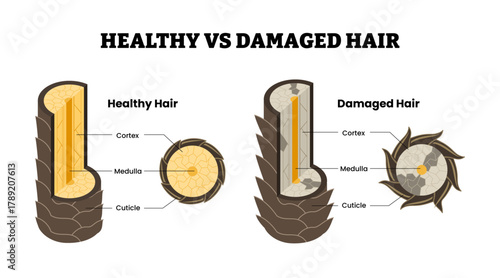 Layer of healthy and damaged hair structure. Labeled cortex, medulla, cuticle cross section view. Hair care beauty concept. Dermatology education. Vector illustration.
